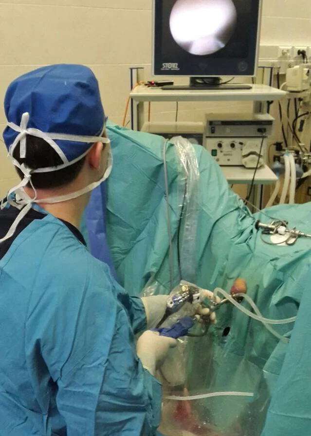 Cirurgia de próstata