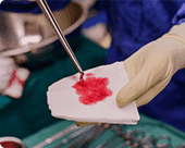 Biópsia da próstata